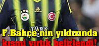 F.Bahçe'nin yıldızında kısmi yırtık...